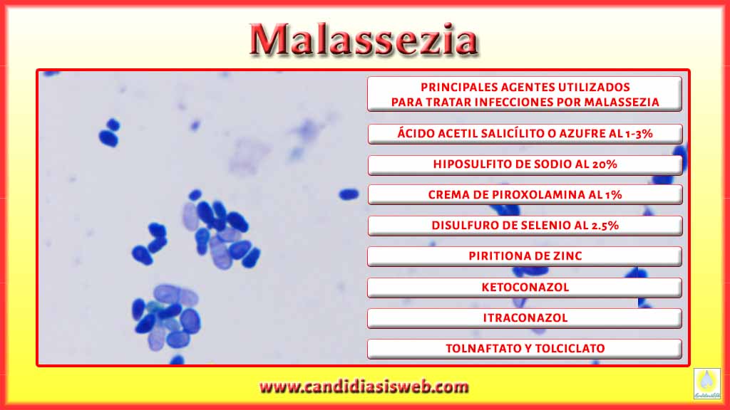 Qu Es Malassezia Qu Es Malassezia